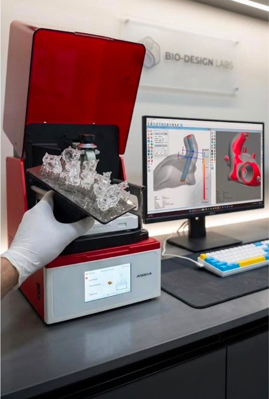 Digital ear-scanning workflow and custom earmold fabrication lab